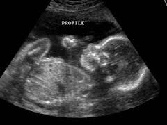 ultrasoundprofile